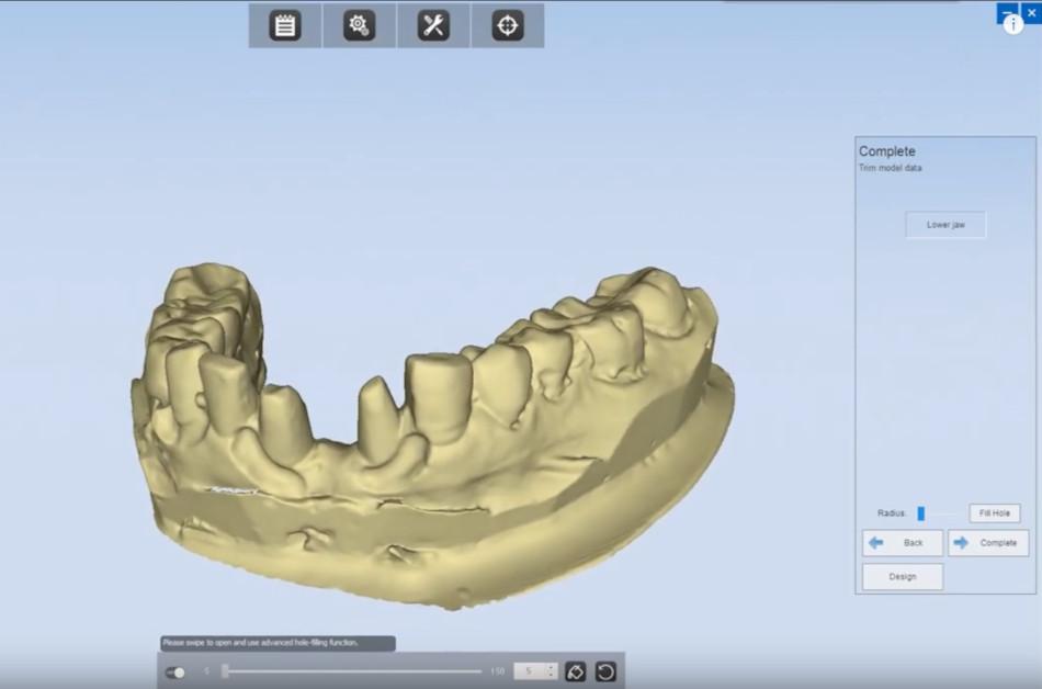 Shining 3D AutoScan-DS-EX Dental 3D-Scanner
